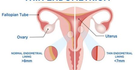 Endometrium & Pregnancy