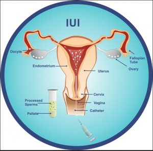 Test tube baby center in nashik