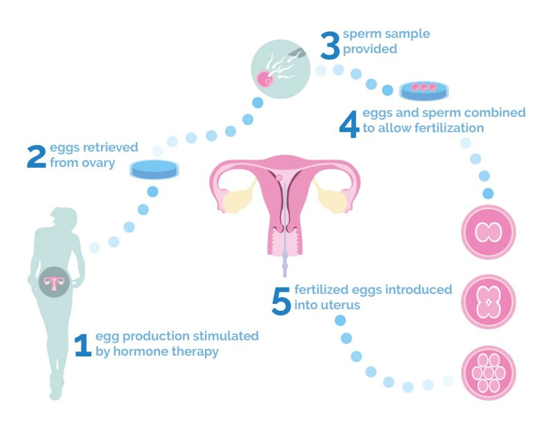 IVF Treatment in Indira Nagar, Nashik